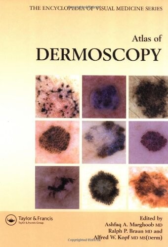 Atlas of dermoscopy