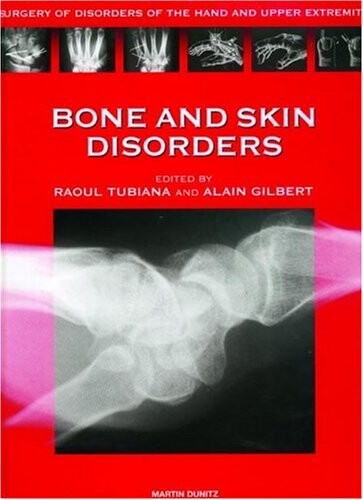 Bone and Skin Disorders: Surgery of Disorders of the Hand and Upper Extremity (Surgery of Disorders of the Hand and Upper Extremity Series)