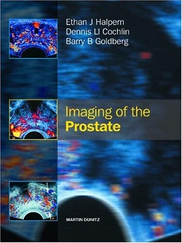 Imaging of the Prostate