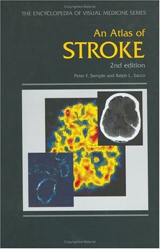 An Atlas of Stroke, Second Edition