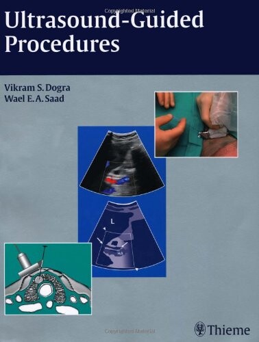 Ultrasound-Guided Procedures