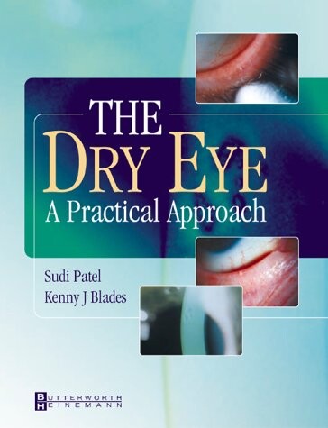 The Dry Eye: A Practical Approach