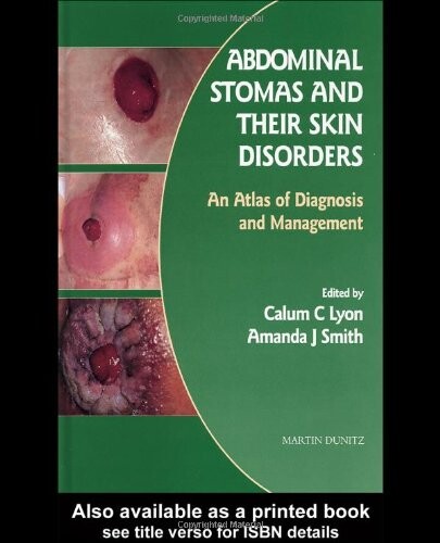 Abdominal stomas and their skin disorders : an atlas of diagnosis and management
