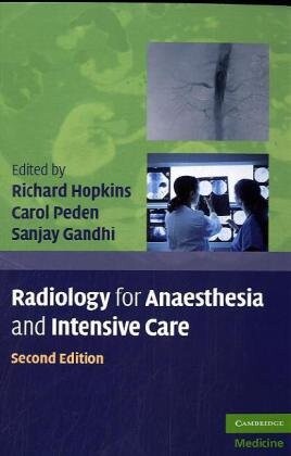 Radiology for Anaesthesia and Intensive Care (Cambridge Medicine)