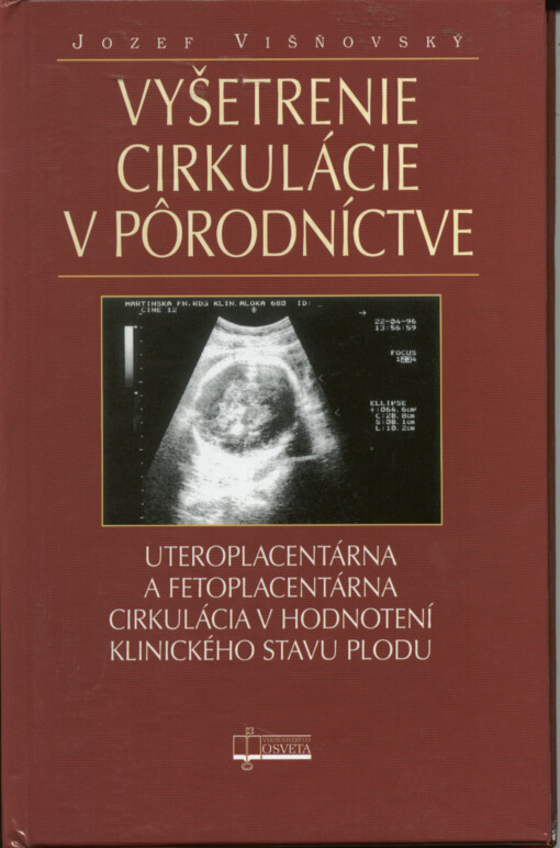 Vyšetrenie cirkulácie v pôrodníctve : uteroplacentárna a fetoplacentárna cirkulácia v hodnotení klinického stavu plodu