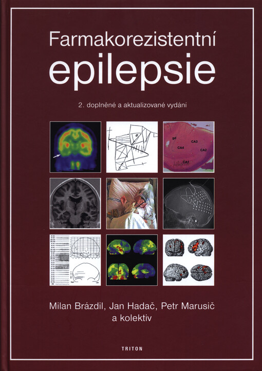 Farmakorezistentní epilepsie