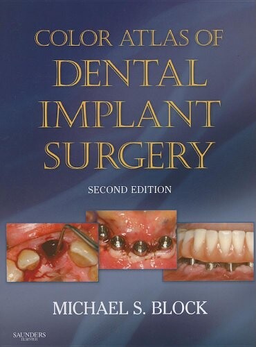 Color atlas of dental implant surgery
