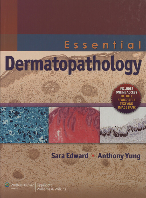 Essential dermatopathology 