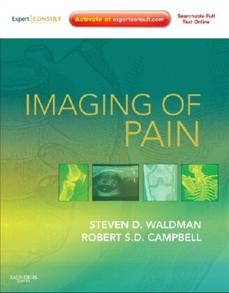 Imaging of Pain: Expert Consult Online Features and Print (Expert Consult Title: Online + Print)