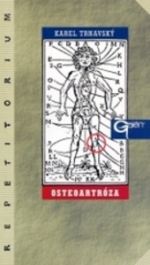 Osteoartróza