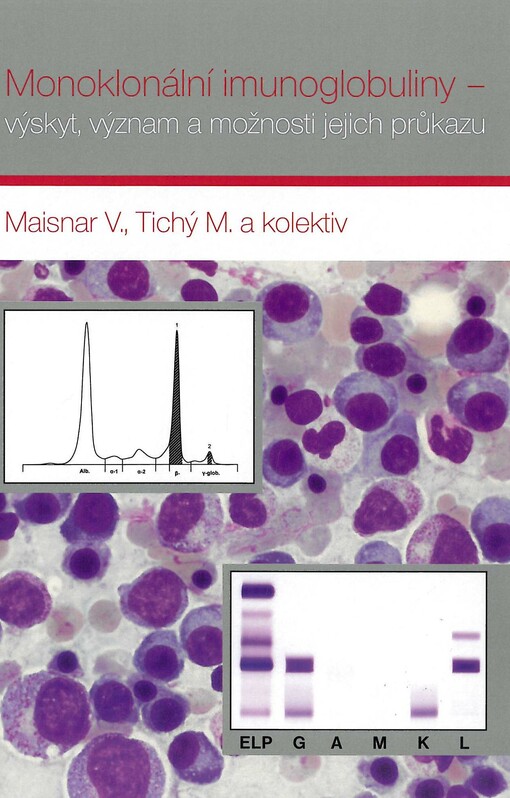 Monoklonální imunoglobuliny - výskyt, význam a možnosti jejich průkazu