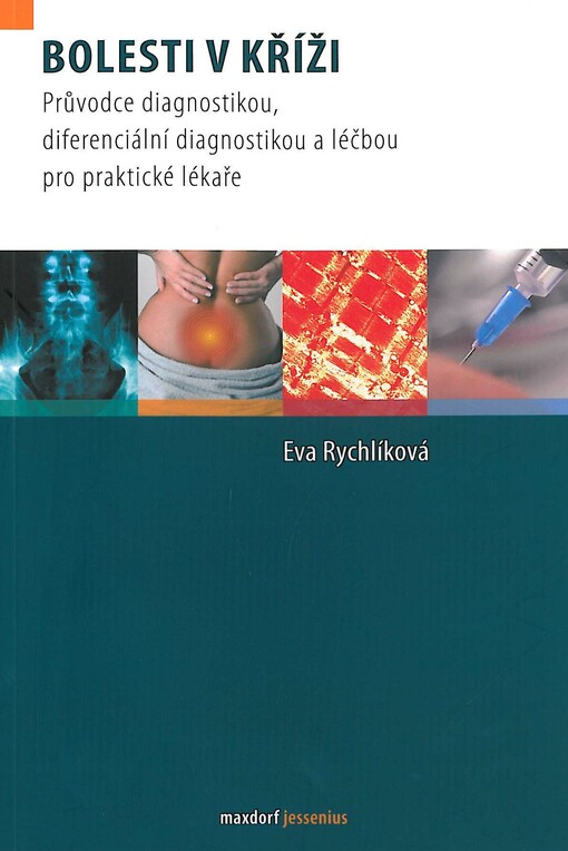 Bolesti v kříži : průvodce diagnostikou, diferenciální diagnostikou a léčbou pro praktické lékaře
