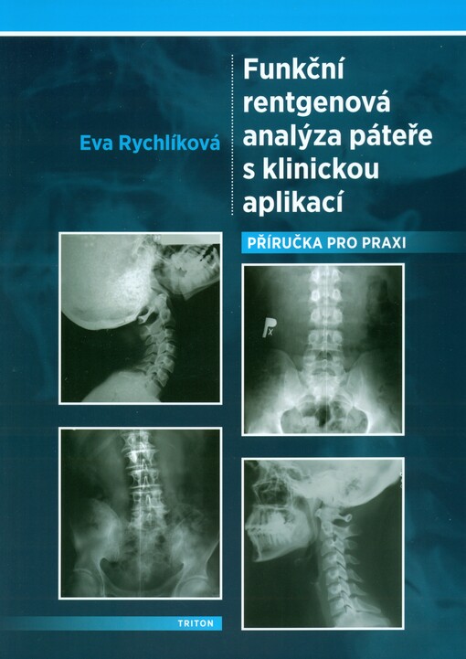 Funkční rentgenová analýza páteře s klinickou aplikací : příručka pro praxi