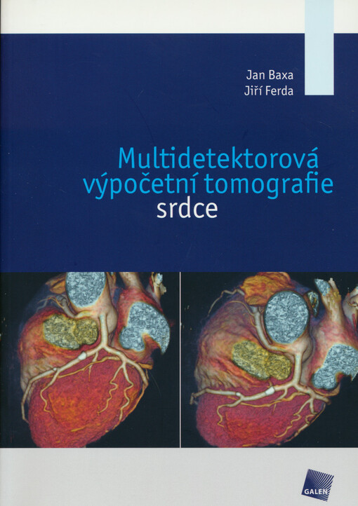 Multidetektorová výpočetní tomografie srdce