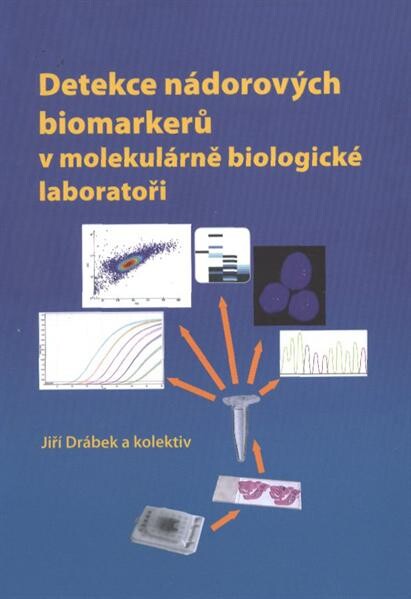 Detekce nádorových biomarkerů v molekulárně biologické laboratoři