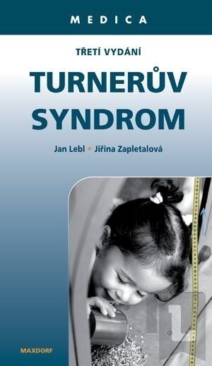 Turnerův syndrom