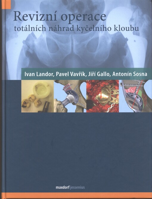 Revizní operace totálních náhrad kyčelního kloubu