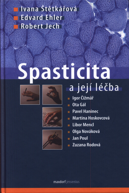 Spasticita a její léčba