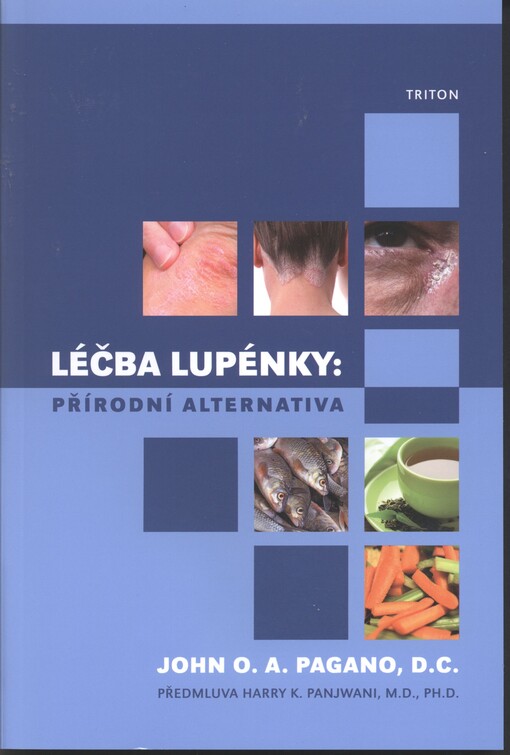 Léčba lupénky: přírodní alternativa