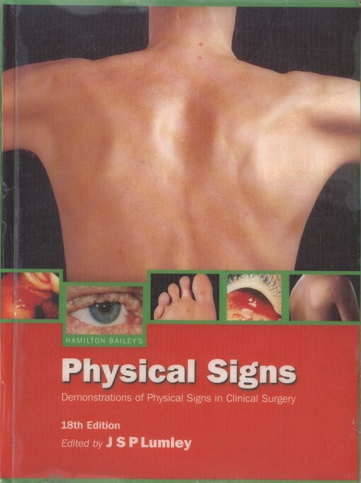 Hamilton Bailey’s physical signs :demonstrations of physical signs in clinical surgery