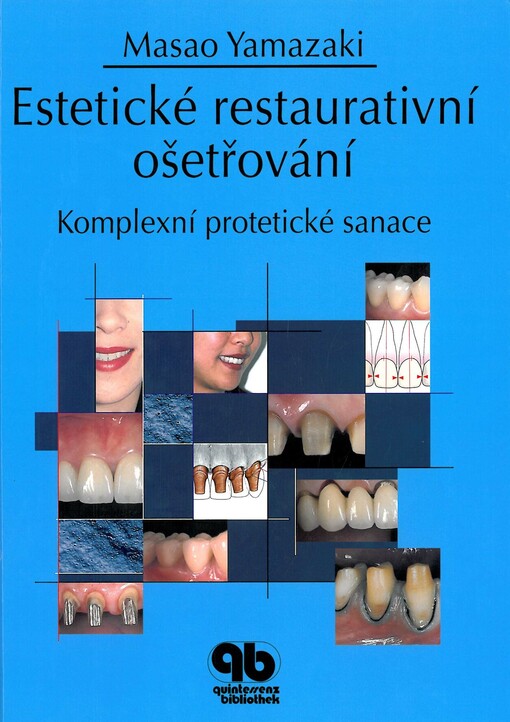Estetické restaurativní ošetřování : komplexní protetické sanace