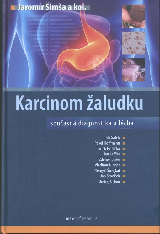 Karcinom žaludku