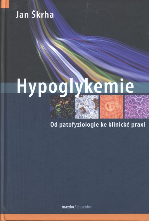 Hypoglykemie :od patofyziologie ke klinické praxi