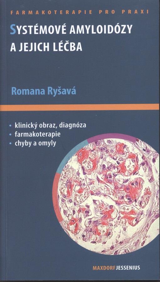 Systémové amyloidózy a jejich léčba