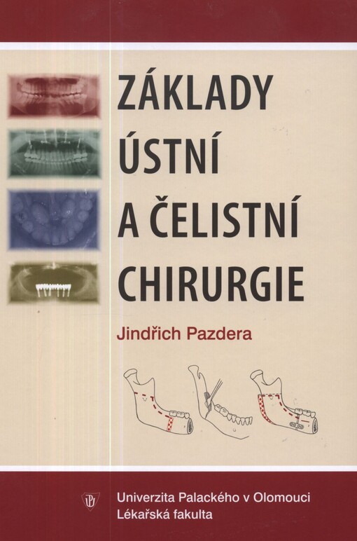 Základy ústní a čelistní chirurgie