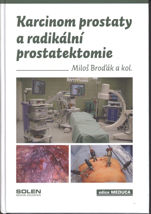 Karcinom prostaty a radikální prostatektomie