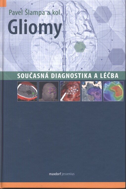 Gliomy :současná diagnostika a léčba