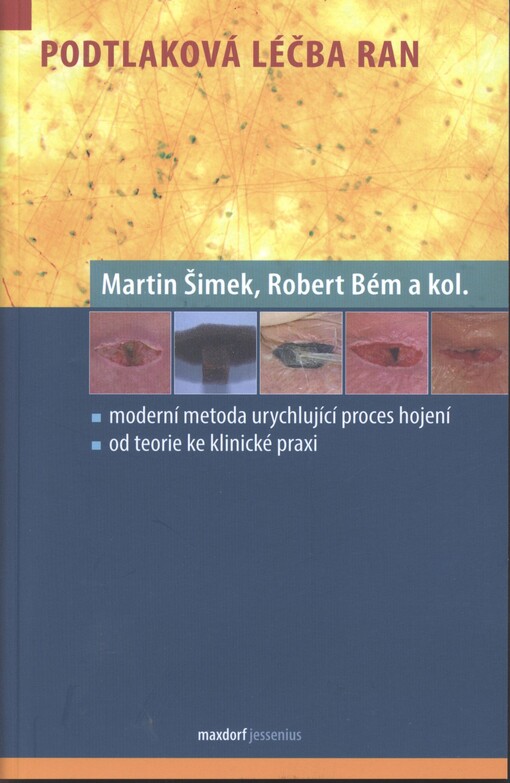 Podtlaková léčba ran