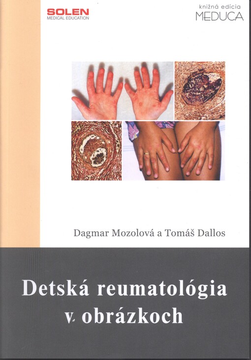 Detská reumatológia v obrázkoch