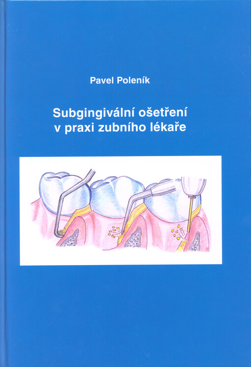 Subgingivální ošetření v praxi zubního lékaře