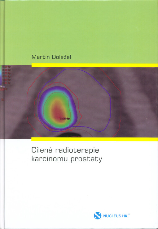 Cílená radioterapie karcinomu prostaty