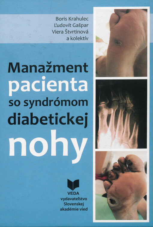 Manažment pacienta so syndrómom diabetickej nohy
