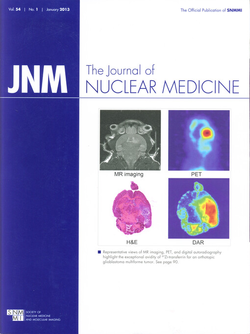 The journal of nuclear medicine : official publication of the Society of Nuclear Medicine   