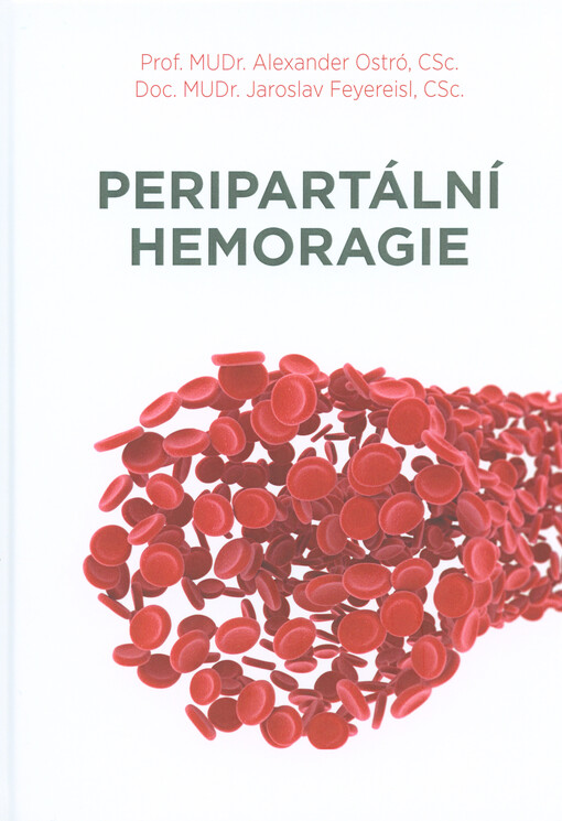 Peripartální hemoragie