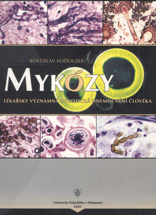 Mykózy: lékařsky významná mykotická onemocnění člověka