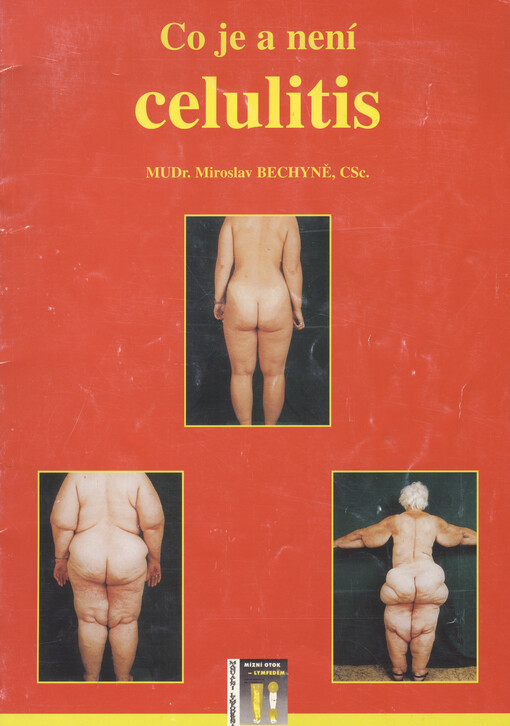 Co je a není celulitis    