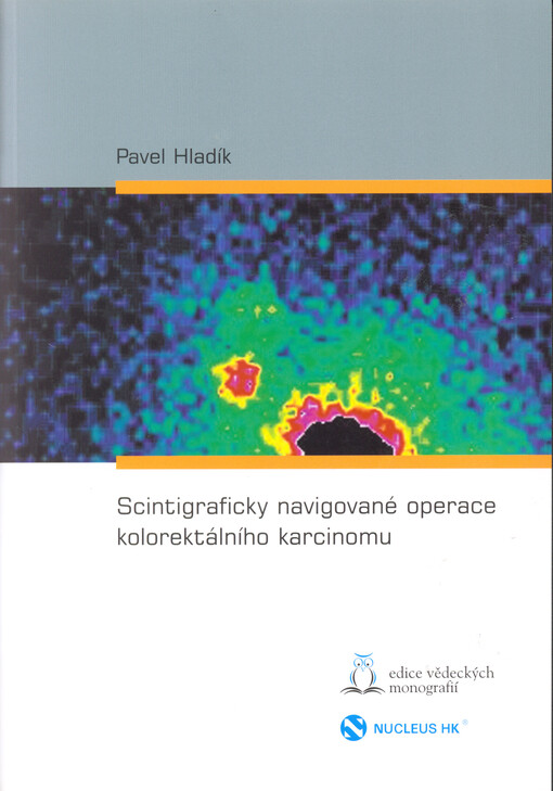 Scintigraficky navigované operace kolorektálního karcinomu