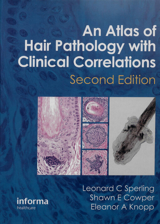 An atlas of hair pathology with clinical correlations
