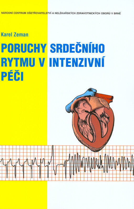 Poruchy srdečního rytmu v intenzivní péči