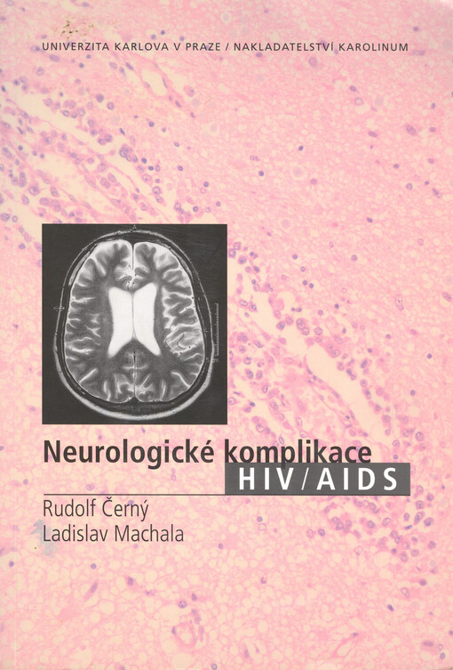 Neurologické komplikace HIV/AIDS