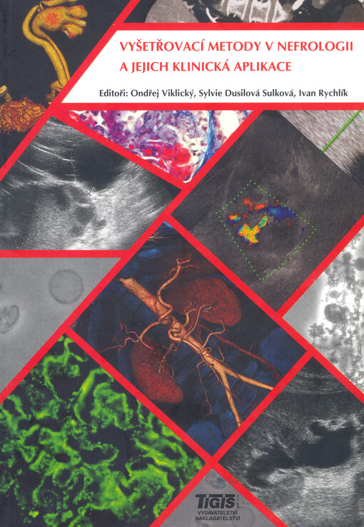 Vyšetřovací metody v nefrologii a jejich klinická aplikace