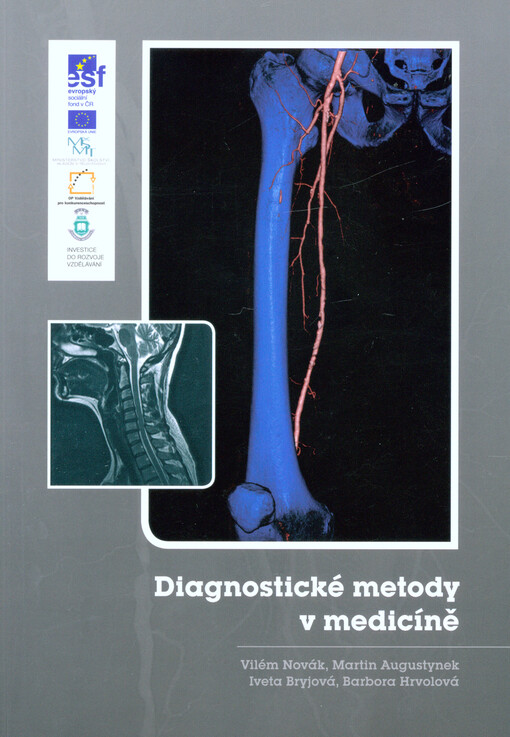 Diagnostické metody v medicíně    