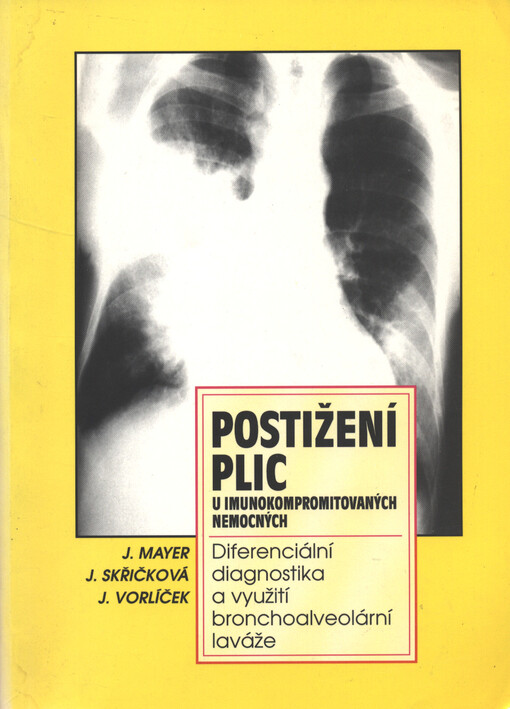 Postižení plic u imunokompromitovaných nemocných :diferenciální diagnostika a využití bronchoalveolární laváže