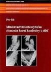 Miniinvazívní osteosyntéza zlomenin horní končetiny u dětí = Miniinvasive osteosythesis of upper extremity fractures in children
