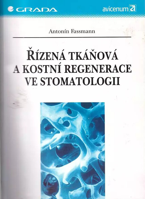 Řízená tkáňová a kostní regenerace ve stomatologii