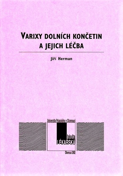 Varixy dolních končetin a jejich léčba